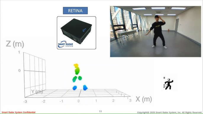Smart Radar System's Touchless Patient Monitoring System showcasing 4D radar technology and API AutoFlow integration